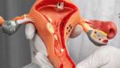 Unbelievable Facts about Uterus: ഗര്‍ഭപാത്രം ഒരു 'ചില്ലറ പാത്രം' അല്ല... ഈ കാര്യങ്ങള്‍ കേട്ടാല്‍ ആരും മൂക്കത്ത് വിരല്‍ വയ്ക്കും!