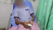Student Attacked: ഒൻപതാം ക്ലാസ് വിദ്യാർത്ഥിയെ സഹപാഠികൾ മർദിച്ചു; ഏഴ് കുട്ടികളെ ജുവനൈൽ ഹോമിലേക്ക് മാറ്റി പോലീസ്