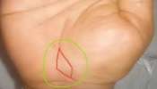Fish Sign in Hand: ഉള്ളം കയ്യിൽ മീനിന്റെ അടയാളമോ? എന്താണ് അർത്ഥം? Fish Sign in Hand: ഉള്ളം കയ്യിൽ മീനിന്റെ അടയാളമോ? എന്താണ് അർത്ഥം?