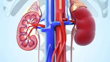Kidney Disease: വൃക്ക രോഗത്തിന്റെ ലക്ഷണങ്ങൾ എന്തൊക്കെ? 