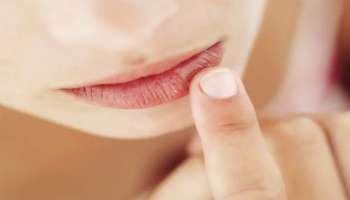 Chapped Lips: ചുണ്ട് വരണ്ട് പൊട്ടുന്നുണ്ടോ? വെളിച്ചെണ്ണ, തേൻ തുടങ്ങി പരിഹരിക്കാൻ 5 വഴികൾ 