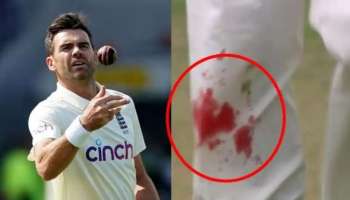 James Anderson: ചോരയൊലിക്കുന്ന കാലുകളുമായി ബൗളിങ് തുടര്‍ന്ന് ആന്‍ഡേഴ്‌സന്‍, കൈയ്യടിച്ച് ക്രിക്കറ്റ് ലോകം