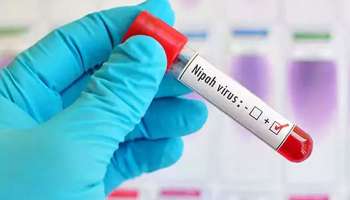 Nipah Virus: കോഴിക്കോട് വീണ്ടും നിപ വൈറസ് സ്ഥിരീകരിച്ചതായി റിപ്പോർട്ട് 