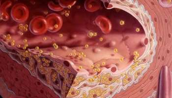 Cholestrol : നിങ്ങൾ കൊളസ്ട്രോൾ കുറയ്ക്കാൻ ശ്രമിക്കുകയാണോ? ഈ ഭക്ഷണങ്ങൾ കഴിക്കുന്നത് ഗുണകരമാണ്