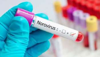 Noro Virus | കേൾക്കാത്ത പേരാണെന്ന് കരുതേണ്ട, നിങ്ങളെയും കടന്ന് പോയിട്ടുണ്ടാവും നോറോ വൈറസ്