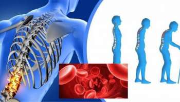 Vitamin B12 Deficiency | വൈറ്റമിൻ കുറവെന്ന് പറഞ്ഞ്  നിങ്ങൾ ഇത്തരം ലക്ഷണങ്ങൾ അവഗണിക്കരുത്, അത് പ്രശ്നമാവും