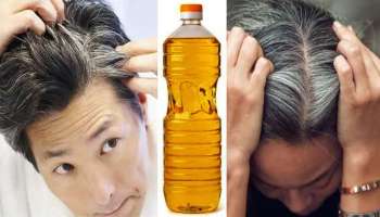 White Hair Remedies : മുടി നരയ്ക്കുന്നത് ബുദ്ധിമുട്ടാകുന്നുണ്ടോ? നര ഒഴിവാക്കാൻ ചില എളുപ്പവഴികൾ