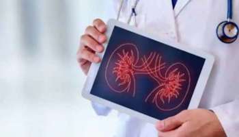 World Kidney Day 2022: എൻസിഡി ക്ലിനിക്കുകളിൽ വൃക്ക രോഗ പരിശോധന    