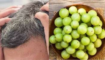 White hair: നരച്ച മുടി കറുപ്പിക്കാം; നെല്ലിക്ക ഇങ്ങനെ ഉപയോ​ഗിക്കൂ...