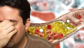 Bad Cholesterol: ഈ 5 ശീലങ്ങള്‍ ഒഴിവാക്കിയാല്‍ ചീത്ത കൊളസ്ട്രോളിനോട് പറയാം ബൈ ബൈ 