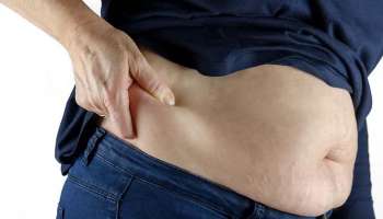 Obesity and Bone Health : അമിതവണ്ണം എല്ലുകളുടെയും സന്ധികളുടെയും ആരോഗ്യത്തെ ബാധിക്കും; അറിയേണ്ടതെല്ലാം