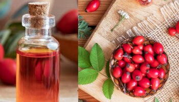 Rosehip Oil Benefits: ചർമ്മ സംരക്ഷണത്തിന് മാത്രമല്ല മുടിയിഴകളുടെ സൗന്ദര്യത്തിനും ഈ ഓയിൽ ബെസ്റ്റാണ്