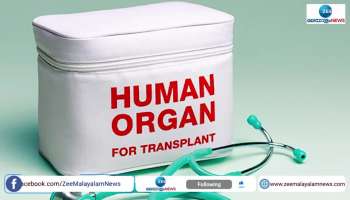 government to improve organ donation surgery system