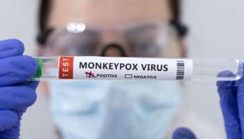 Monkeypox:  മങ്കിപോക്സ്‌ വിലയിരുത്താൻ കേന്ദ്ര സംഘം കേരളത്തിൽ 