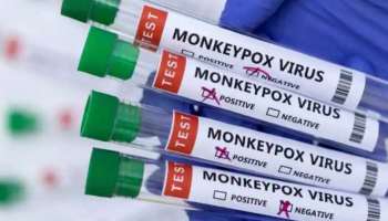 Monkeypox in children: യുഎസിൽ രണ്ട് കുട്ടികൾക്ക് മങ്കിപോക്സ് സ്ഥിരീകരിച്ചു