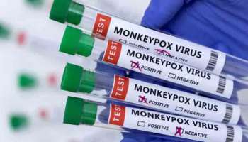 Monkeypox : മങ്കിപോക്സ് 72 രാജ്യങ്ങളിൽ സ്ഥിരീകരിച്ചു; വാനരവസൂരി ആഗോള പകർച്ചവ്യാധിയെന്ന് WHO