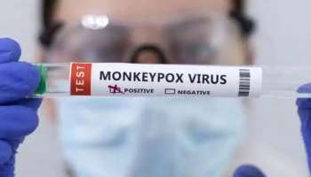 Monkeypox Delhi : ഡൽഹിയിലും വാനരവസൂരി സ്ഥിരീകരിച്ചു; രോഗി വിദേശയാത്രകൾ നടത്തിയിട്ടില്ല