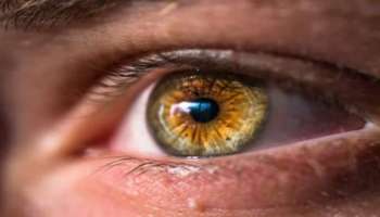 Dry Eyes Syndrome: കണ്ണുകൾ വരണ്ടതാകുന്നോ? കാരണങ്ങളും പ്രതിവിധിയും അറിയാം...