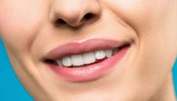 Oral health: പല്ലുകളുടെ നിറവ്യത്യാസത്തിന് പിന്നിലെ ആരോ​ഗ്യകാരണങ്ങൾ