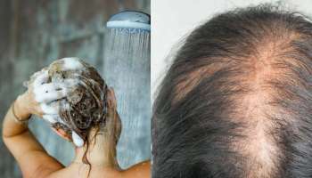Hair care Tips: ഇക്കാര്യങ്ങള്‍ ശ്രദ്ധിച്ചാല്‍ മുടി കൊഴിച്ചില്‍ പമ്പ കടക്കും