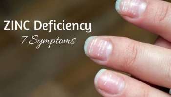 Zinc Deficiency: ശരീരത്തിൽ സിങ്കിന്റെ അഭാവം ഉണ്ടോ? ഈ ലക്ഷണങ്ങൾ ശ്രദ്ധിക്കാം