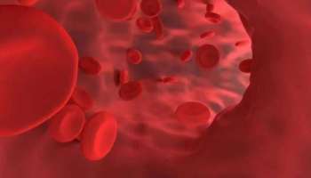 Anemia: വിളർച്ചയുണ്ടോ? ഈ അഞ്ച് ഭക്ഷണങ്ങൾ മറക്കാതെ കഴിക്കാം