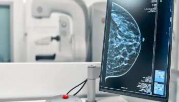 Breast Cancer Screening: കൃത്യമായ ഇടവേളകളിൽ സ്ത്രീകളിൽ സ്തനാർബുദ പരിശോധന നടത്തേണ്ടതിന്റെ പ്രാധാന്യമെന്ത്?