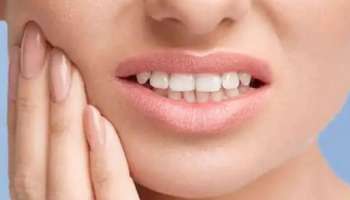 Dental Problems: പല്ലിനെ ബാധിക്കുന്ന പ്രധാന രോ​ഗങ്ങൾ ഇവയാണ്; അറിഞ്ഞിരിക്കാം... പ്രതിരോധിക്കാം