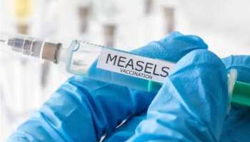 Measles outbreak in Malappuram: മലപ്പുറം ജില്ലയിലെ അഞ്ചാംപനി വ്യാപനം: കേന്ദ്ര സംഘം ഇന്ന് കേരളത്തിലെത്തും