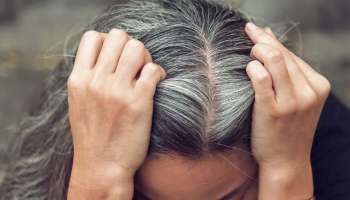 Mustard Seeds For Premature Greying: നരച്ച മുടി കറുപ്പിക്കാം, ഈ ഐഡിയ പ്രയോഗിച്ചു നോക്കൂ