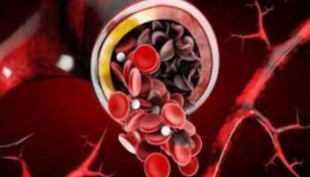 Blood disorders: രക്തജന്യരോ​ഗമുള്ളവർക്ക് ആശ്വാസമായി ‘ആശാധാര’ പദ്ധതി