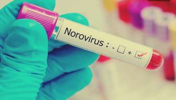 Noro Virus: എന്താണ് നോറോ വൈറസ്? രോഗ ലക്ഷണങ്ങള്‍ എന്താണ്? പകരുന്നത് എങ്ങിനെ? അറിയാം 