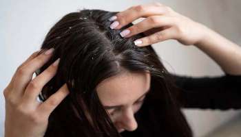 Dandruff Remedies: താരന്‍ തുരത്താം, ഈ വീട്ടുവൈദ്യങ്ങള്‍ പരീക്ഷിക്കൂ.. 