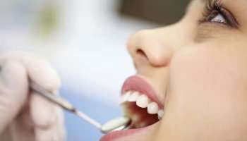 Teeth Health: മഞ്ഞപ്പല്ലുകള്‍ക്ക് ബൈ ബൈ, പല്ലുകള്‍ മുത്ത് പോലെ വെട്ടിത്തിളങ്ങാന്‍ ഇതാ വഴിയുണ്ട് 