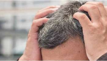 Hair care: മുടിയിലെ നര മാറ്റണോ? ഈ ആഹാര സാധനങ്ങൾ ഒഴിവാക്കൂ