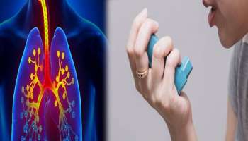 Asthma Day 2023: ആസ്മയെ പ്രതിരോധിക്കാൻ ശ്രദ്ധിക്കണം ഇക്കാര്യങ്ങൾ