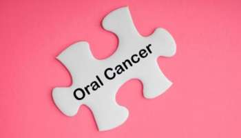 Oral Health: ഓറൽ ക്യാൻസറിന്റെ ലക്ഷണങ്ങളെ തിരിച്ചറിയാം, പ്രതിരോധിക്കാം