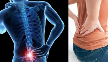 Reasons For Constant Back Pain: എന്തു ചെയതിട്ടും നടുവേദന മാറുന്നില്ലേ...? കാരണങ്ങൾ ഇതാകാം
