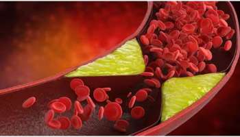 Bad Cholesterol: ശരീരത്തിലെ ചീത്ത കൊളസ്‌ട്രോൾ കുറയ്ക്കണോ? ഡയറ്റിൽ ഇവ ഉൾപ്പെടുത്തൂ