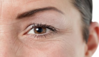 Wrinkles Causes: പ്രായമാകും മുൻപേ ചുളിവുകൾ! ഇതൊക്കെയാണ് കാരണങ്ങൾ