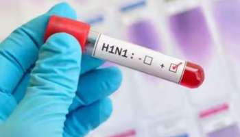 H1N1: മലപ്പുറത്ത് H1N1 ബാധിച്ച് പതിമൂന്നുകാരൻ മരിച്ചു