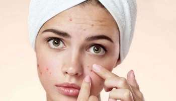 Skin Care Mistakes: മുഖക്കുരു ബുദ്ധിമുട്ടിക്കുന്നുവെങ്കില്‍ ഉടന്‍ മാറ്റാം ചർമ്മ സംരക്ഷണ ദിനചര്യ  