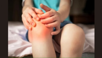 Juvenile Arthritis: കുട്ടികളെ ബാധിക്കുന്ന ജുവനൈൽ ആർത്രൈറ്റിസ്; അവ​ഗണിക്കരുത് ഈ ലക്ഷണങ്ങൾ