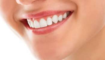 Healthy Teeth And Gums: വായുടെ ശുചിത്വം മികച്ചതാക്കാം... പല്ലിന്റെയും മോണയുടെയും ആരോ​ഗ്യം സംരക്ഷിക്കാൻ ഈ ഭക്ഷണങ്ങൾ കഴിക്കാം