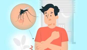 Malaria: മലേറിയ കേസുകൾ വർധിക്കുന്നു; സ്വയം പ്രതിരോധം പ്രധാനം, ഇക്കാര്യങ്ങൾ ശ്രദ്ധിക്കാം