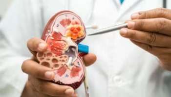 Worst Food For Kidney: ഈ ഭക്ഷണങ്ങള്‍ കിഡ്നിക്ക് ഹാനികരം, അബദ്ധത്തിൽ പോലും കഴിയ്ക്കുന്നത്‌ ഒഴിവാക്കാം 