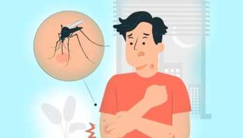 Dengue Fever: ഡെങ്കപ്പനി പരത്തുന്ന കൊതുകുകൾ പകൽ മാത്രമാണോ മനുഷ്യരെ കടിക്കുന്നത്? വാസ്തവം ഇതാണ് 