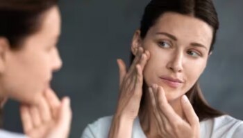 Acne Problem: മുഖക്കുരുവാണ്, ശ്രദ്ധിച്ച് കൈകാര്യം ചെയ്യണം; തടയാൻ ഫലപ്രദമായ മാർ​ഗങ്ങൾ ഇതാ!