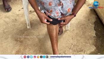 Wild Boar Attack in Idukki Nedugandam