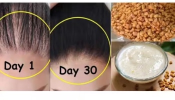 Fenugreek for Hair: മുടിയുടെ വളർച്ചയ്ക്കും താരൻ അകറ്റാനും ഉലുവ ഇങ്ങനെ ഉപയോ​ഗിക്കൂ..!